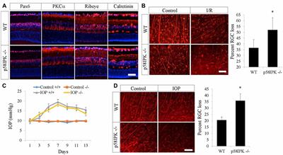 p58IPK Is an Endogenous Neuroprotectant for Retinal Ganglion Cells